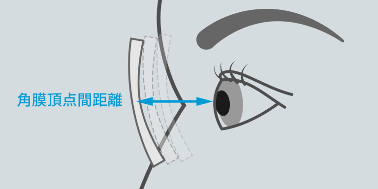 角膜頂点間距離の図解